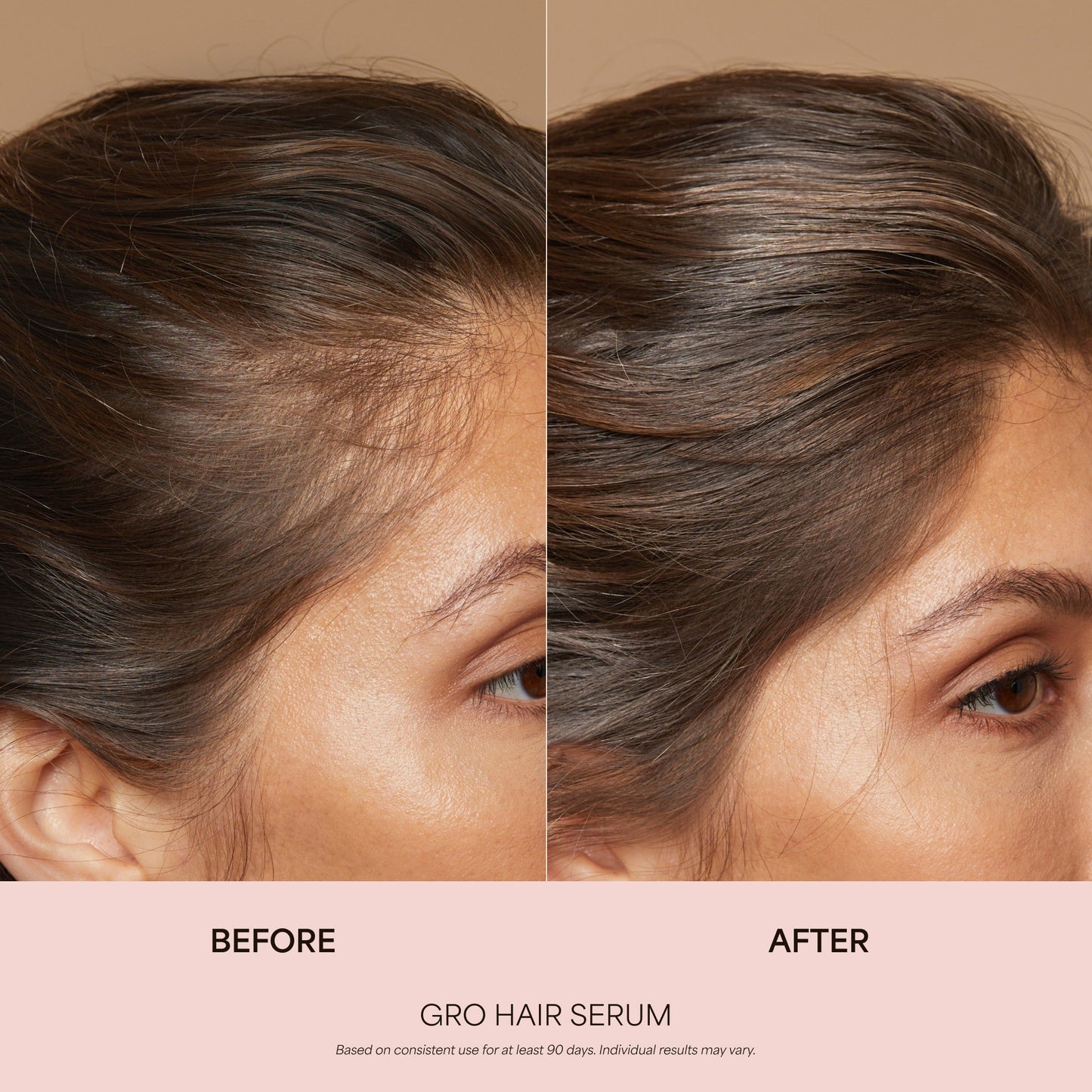GRO Hair Serum